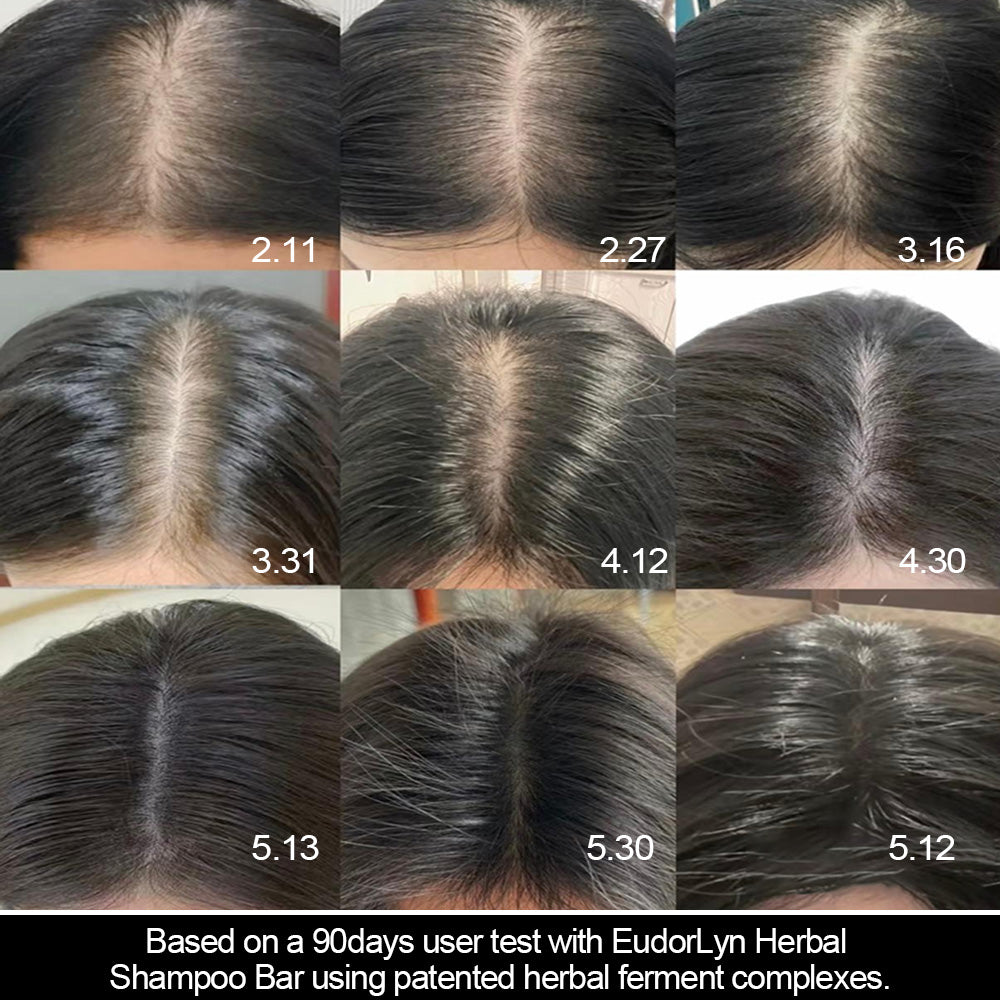 Hair Growth & Scalp Repair Shampoo Bar