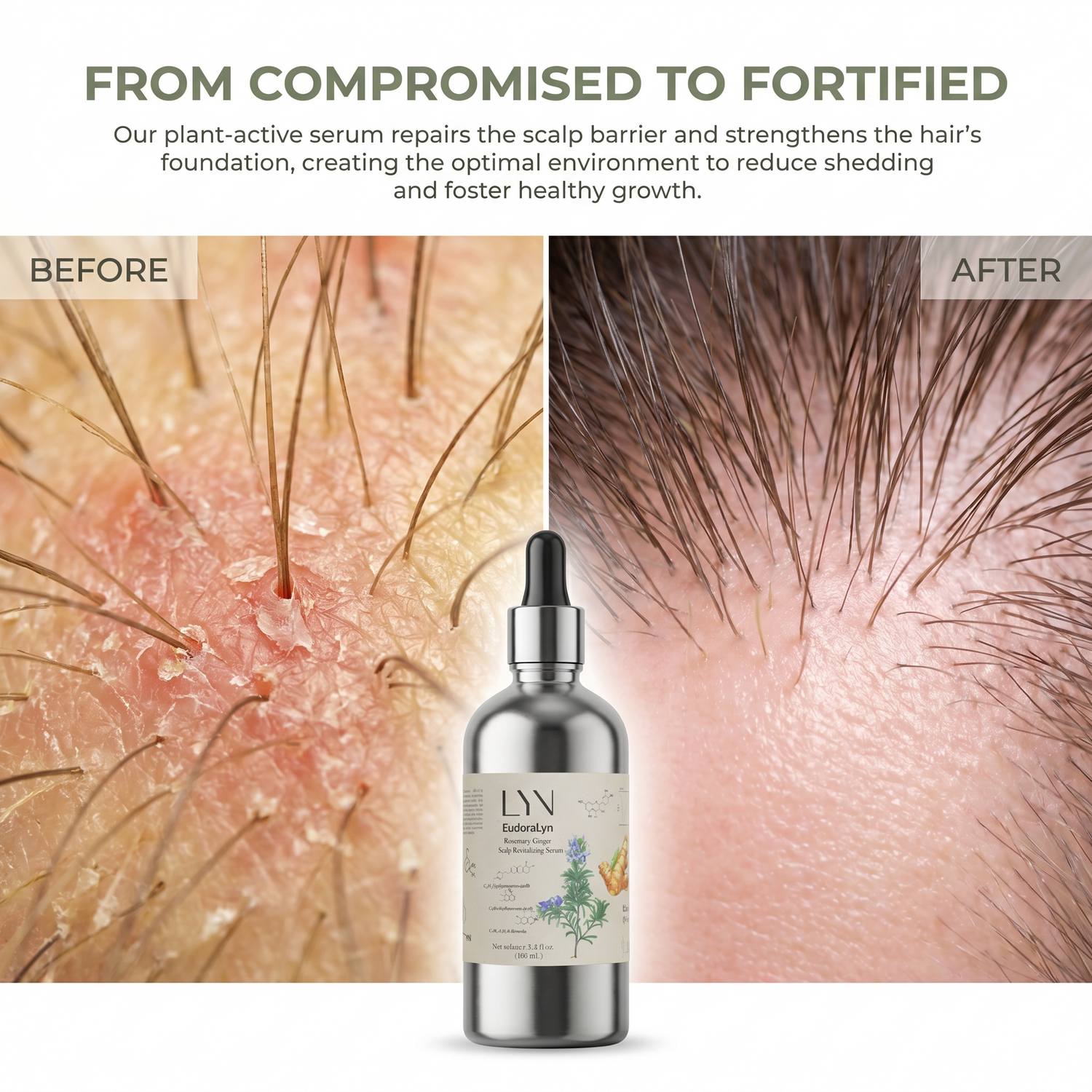 Advanced Rosemary &amp; Adenosine Hair Regrowth Scalp Oil