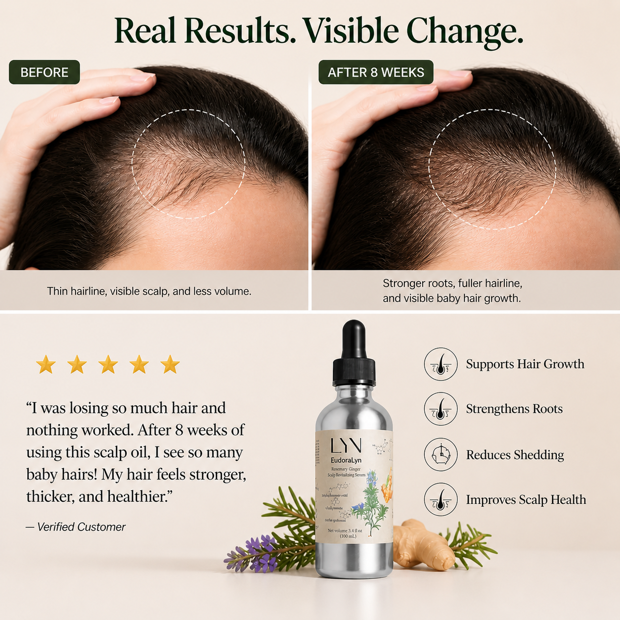 Advanced Rosemary &amp; Adenosine Hair Regrowth Scalp Oil